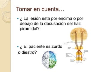 Tomar en cuenta…
   ¿ La lesión esta por encima o por
    debajo de la decusación del haz
    piramidal?



¿ El paciente es zurdo
o diestro?
 