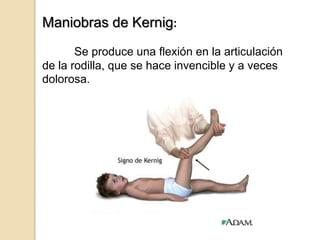 Maniobras de Kernig:
       Se produce una flexión en la articulación
de la rodilla, que se hace invencible y a veces
dolorosa.
 