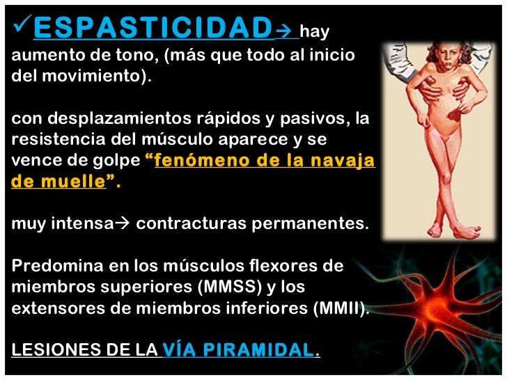 Sistema motor