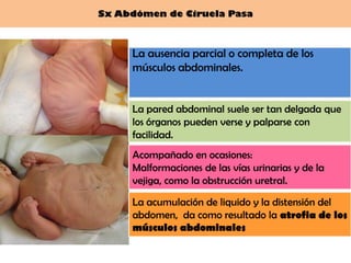 Sx Abdómen de Ciruela Pasa



     La ausencia parcial o completa de los
     músculos abdominales.


     La pared abdominal suele ser tan delgada que
     los órganos pueden verse y palparse con
     facilidad.
     Acompañado en ocasiones:
     Malformaciones de las vías urinarias y de la
     vejiga, como la obstrucción uretral.

     La acumulación de liquido y la distensión del
     abdomen, da como resultado la atrofia de los
     músculos abdominales
 