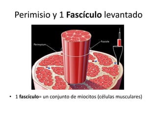 Perimisio y 1 Fascículo levantado
• 1 fascículo= un conjunto de miocitos (células musculares)
 