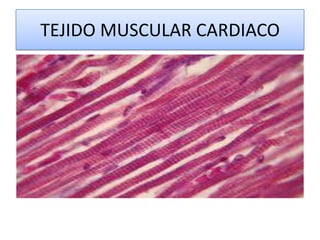 TEJIDO MUSCULAR CARDIACO

 