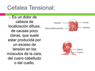 Cefalea Tensional:
 Es un dolor de
cabeza de
localización difusa,
de causas poco
claras, que suele
estar producida por
un exceso de
tensión en los
músculos de la cara,
del cuero cabelludo
o del cuello.
 