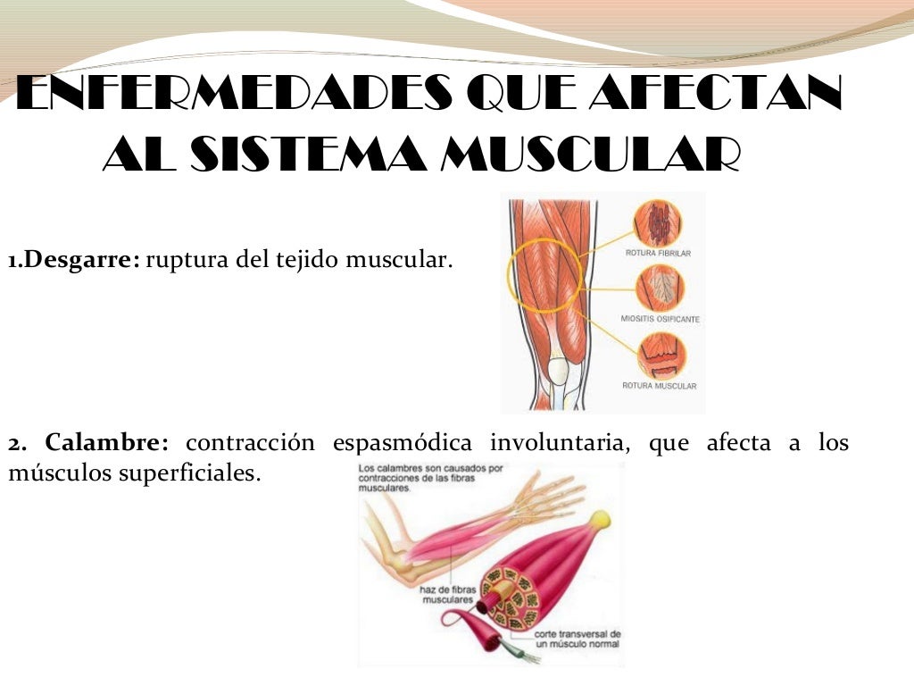 Enfermedades del Sistema muscular