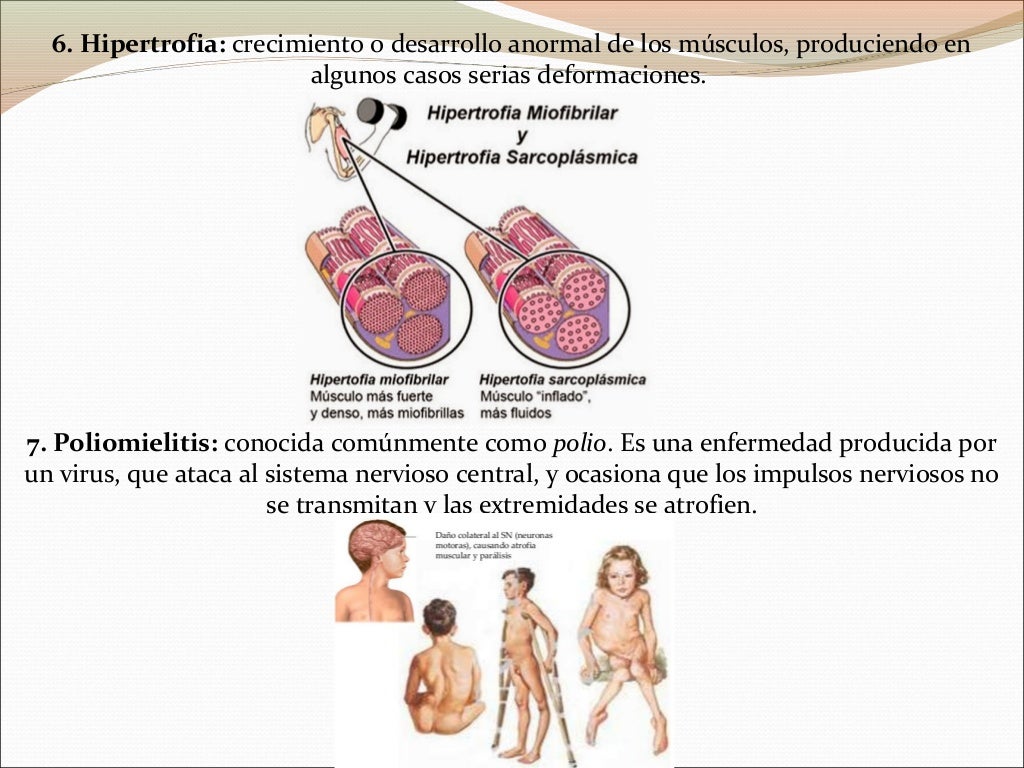 Enfermedades del Sistema muscular