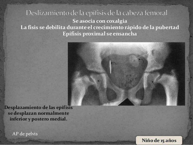 El tratamiento el entumecimiento del pie a los dolores en la espalda