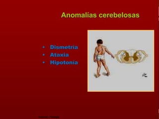 c
                                                                   Sistema Nervioso


                                                 Anomalías cerebelosas

   Sistema Nervioso

           Histología

     Médula espinal         • Dismetría
     Bulbo raquídeo
                            • Ataxia
Protuberancia anular        • Hipotonía
            Cerebelo

       ´Mesencéfalo

          Diencéfalo

             Cerebro

      S. N. Periférico

     S. N. Autónomo


                         Anatomía y Fisiología                                  41
 