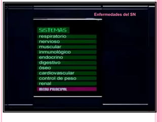Enfermedades del SN
 