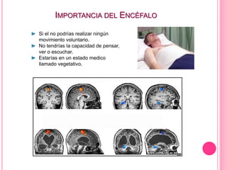 IMPORTANCIA DEL ENCÉFALO
Si el no podrías realizar ningún
movimiento voluntario.
No tendrías la capacidad de pensar,
ver o escuchar.
Estarías en un estado medico
llamado vegetativo.
 