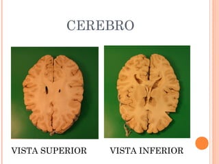 CEREBRO
VISTA SUPERIOR VISTA INFERIOR
 