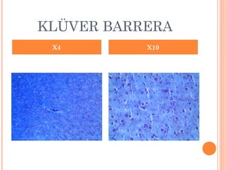 KLÜVER BARRERA
X4 X10
 