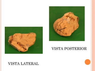 VISTA LATERAL
VISTA POSTERIOR
 