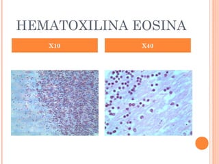 HEMATOXILINA EOSINA
X10 X40
 