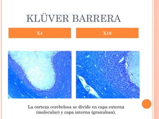 KLÜVER BARRERA
X4 X10
La corteza cerebelosa se divide en capa externa
(molecular) y capa interna (granulosa).
 