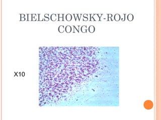 BIELSCHOWSKY-ROJO
CONGO
X10
 