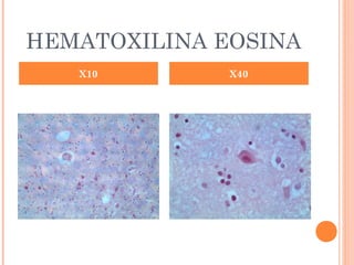 HEMATOXILINA EOSINA
X10 X40
 