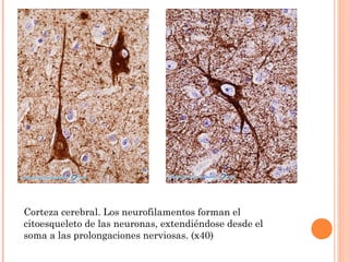 Corteza cerebral. Los neurofilamentos forman el
citoesqueleto de las neuronas, extendiéndose desde el
soma a las prolongaciones nerviosas. (x40)
 
