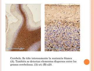 Cerebelo. Se tiñe intensamente la sustancia blanca
(A). También se detectan elementos dispersos entre los
granos cerebelosos. (A) x4; (B) x20.
 