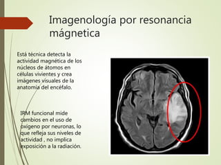 Imagenología por resonancia
mágnetica
Está técnica detecta la
actividad magnética de los
núcleos de átomos en
células vivientes y crea
imágenes visuales de la
anatomía del encéfalo.
IRM funcional mide
cambios en el uso de
oxígeno por neuronas, lo
que refleja sus niveles de
actividad , no implica
exposición a la radiación.
 