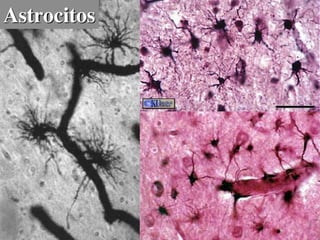 Astrocitos
 