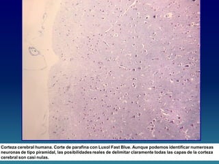 Corteza cerebral humana. Corte de parafina con Luxol Fast Blue. Aunque podemos identificar numerosas
neuronas de tipo piramidal, las posibilidades reales de delimitar claramente todas las capas de la corteza
cerebral son casi nulas.
 