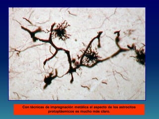 Con técnicas de impregnación metálica el aspecto de los astrocitos
protoplásmicos es mucho más claro.
 