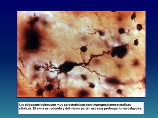 Los oligodendrocitos son muy característicos con impregnaciones metálicas
clásicas. El soma es redondo y del mismo parten escasas prolongaciones delgadas.
 