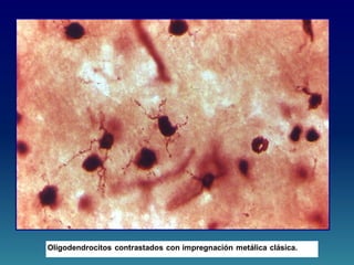 Oligodendrocitos contrastados con impregnación metálica clásica.
 