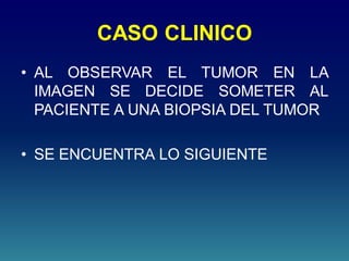 CASO CLINICO
• AL OBSERVAR EL TUMOR EN LA
IMAGEN SE DECIDE SOMETER AL
PACIENTE A UNA BIOPSIA DEL TUMOR
• SE ENCUENTRA LO SIGUIENTE
 