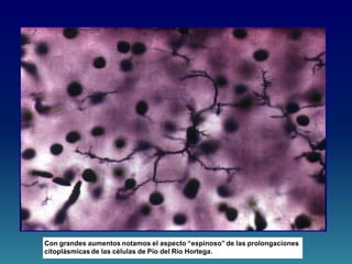 Con grandes aumentos notamos el aspecto “espinoso” de las prolongaciones
citoplásmicas de las células de Pío del Río Hortega.
 