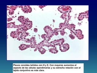 Plexos coroides teñidos con H y E. Con mayores aumentos el
aspecto de las células ependimarias y su estrecha relación con el
tejido conjuntivo es más clara.
 