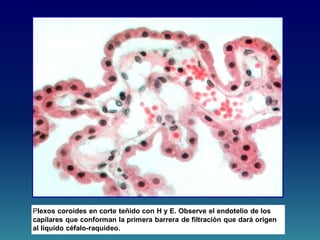Plexos coroides en corte teñido con H y E. Observe el endotelio de los
capilares que conforman la primera barrera de filtración que dará origen
al líquido céfalo-raquídeo.
 