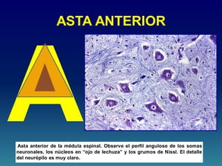 ASTA ANTERIOR
Asta anterior de la médula espinal. Observe el perfil anguloso de los somas
neuronales, los núcleos en “ojo de lechuza” y los grumos de Nissl. El detalle
del neurópilo es muy claro.
 