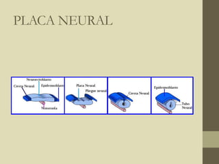 PLACA NEURAL
 