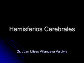 Hemisferios Cerebrales


  Dr. Juan Ulises Villanueva Valdivia
 