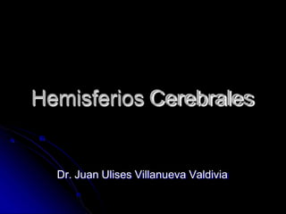 Hemisferios Cerebrales
Dr. Juan Ulises Villanueva Valdivia
 