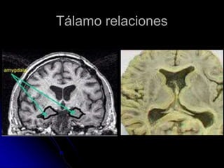 Tálamo relaciones
 