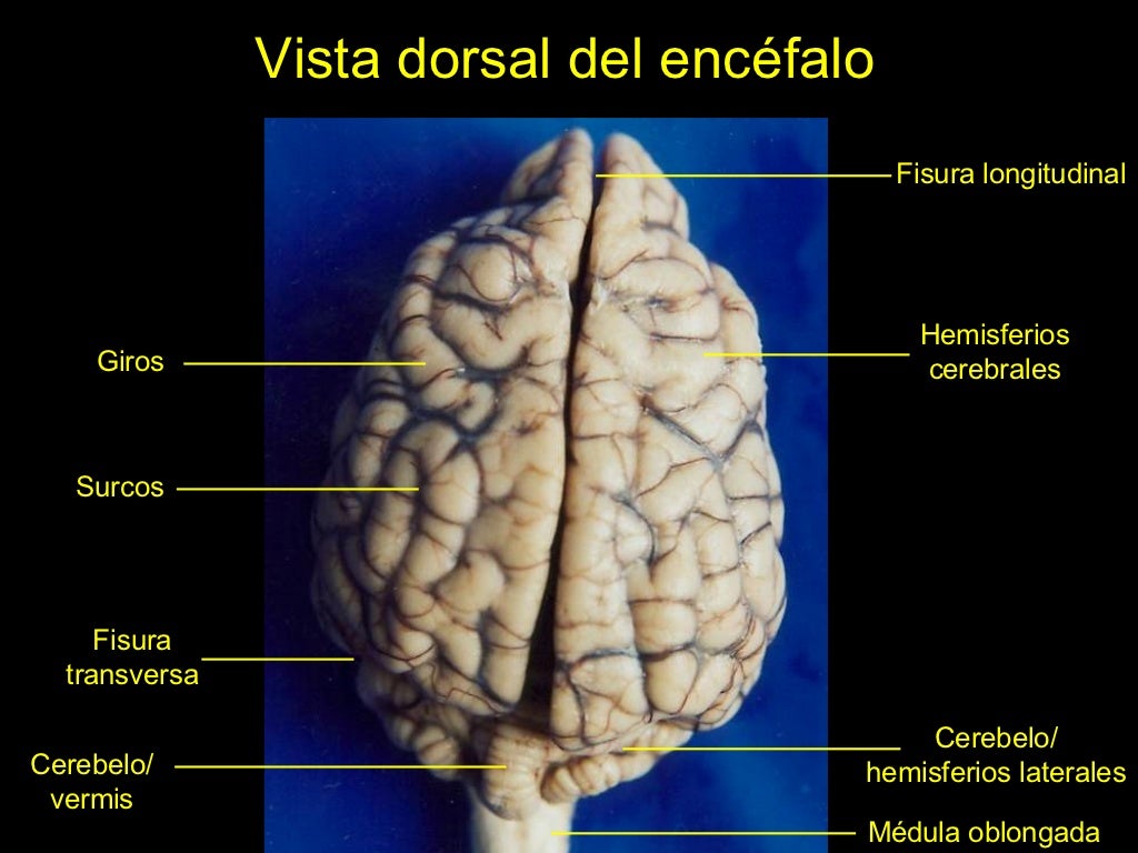 Cerebro De Ovelha Infundibulo