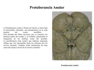 Protuberancia Anular
La Protuberancia Anular o Puente de Varolio se ubica bajo
el mesencéfalo, formando una protuberancia en la zona
anterior del tronco encefálico.
Está formada por fibras nerviosas que se conectan con
distintas partes del cerebro y el cerebelo, permitiendo la
integración de las distintas zonas del encéfalo.
La protuberancia tiene centros que elaboran respuestas
reflejas que son transmitidas hasta los efectores por los
nervios craneales. También recibe información de otras
zonas del cuerpo a través de los nervios craneales.
Protuberancia Anular
 