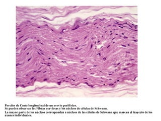 Porción de Corte longitudinal de un nervio periférico.
Se pueden observar las Fibras nerviosas y los núcleos de células de Schwann.
La mayor parte de los núcleos corresponden a núcleos de las células de Schwann que marcan el trayecto de los
axones individuales.
 