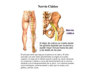 Nervio Ciático
 