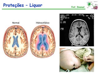 Prof. Emanuel
Proteções – Liquor
 