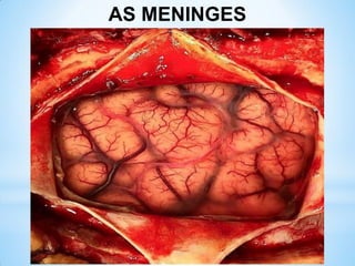 AS MENINGES
 