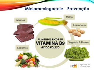 Mielomeningocele - Prevenção
 