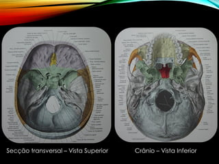 Secção transversal – Vista Superior Crânio – Vista Inferior
 