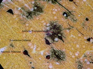 Astrôcito Protoplasmático Neurônio Pirâmidal Substância Cinzenta 