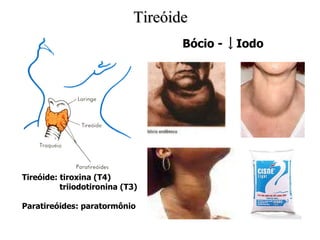 Tireóide Tireóide: tiroxina (T4) triiodotironina (T3) Paratireóides: paratormônio Bócio -  Iodo 