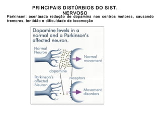 PRINCIPAIS DISTÚRBIOS DO SIST.
NERVOSO

Parkinson: acentuada redução de dopamina nos centros motores, causando
tremores, lentidão e dificuldade de locomoção

 