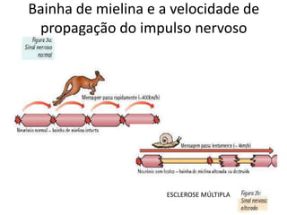 Bainha de mielina e a velocidade de propagação do impulso nervosoESCLEROSE MÚLTIPLA