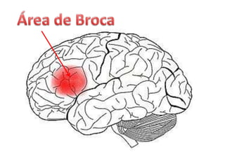 Área de Broca
